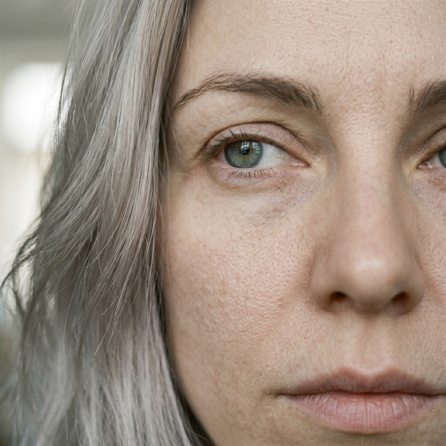 Dullness & Tired Skin